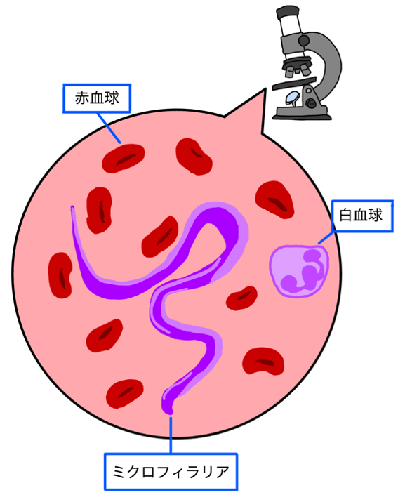 ミクロフィラリア検査